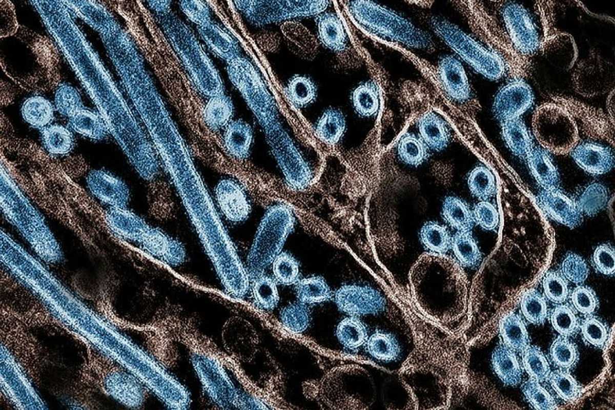 US reports first bird-flu case in a child