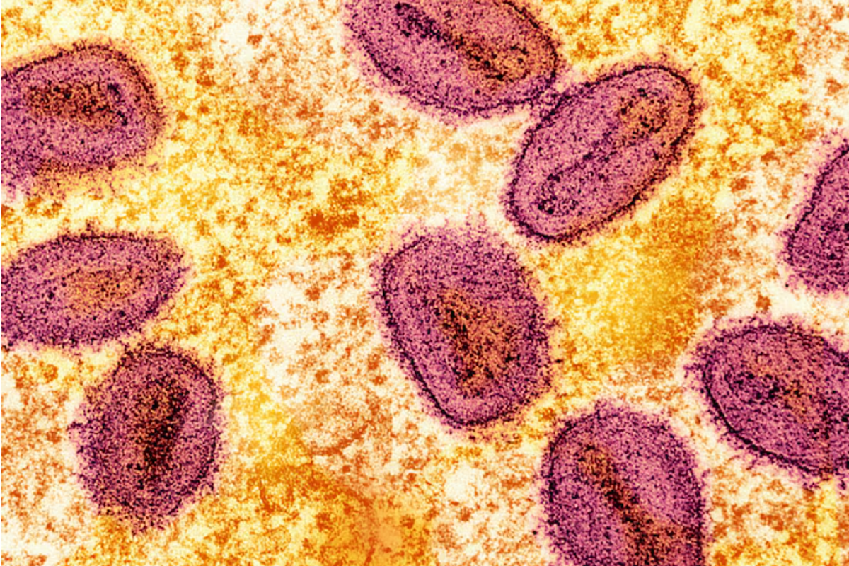 Philippines detects first mpox case this year, yet to determine strain
