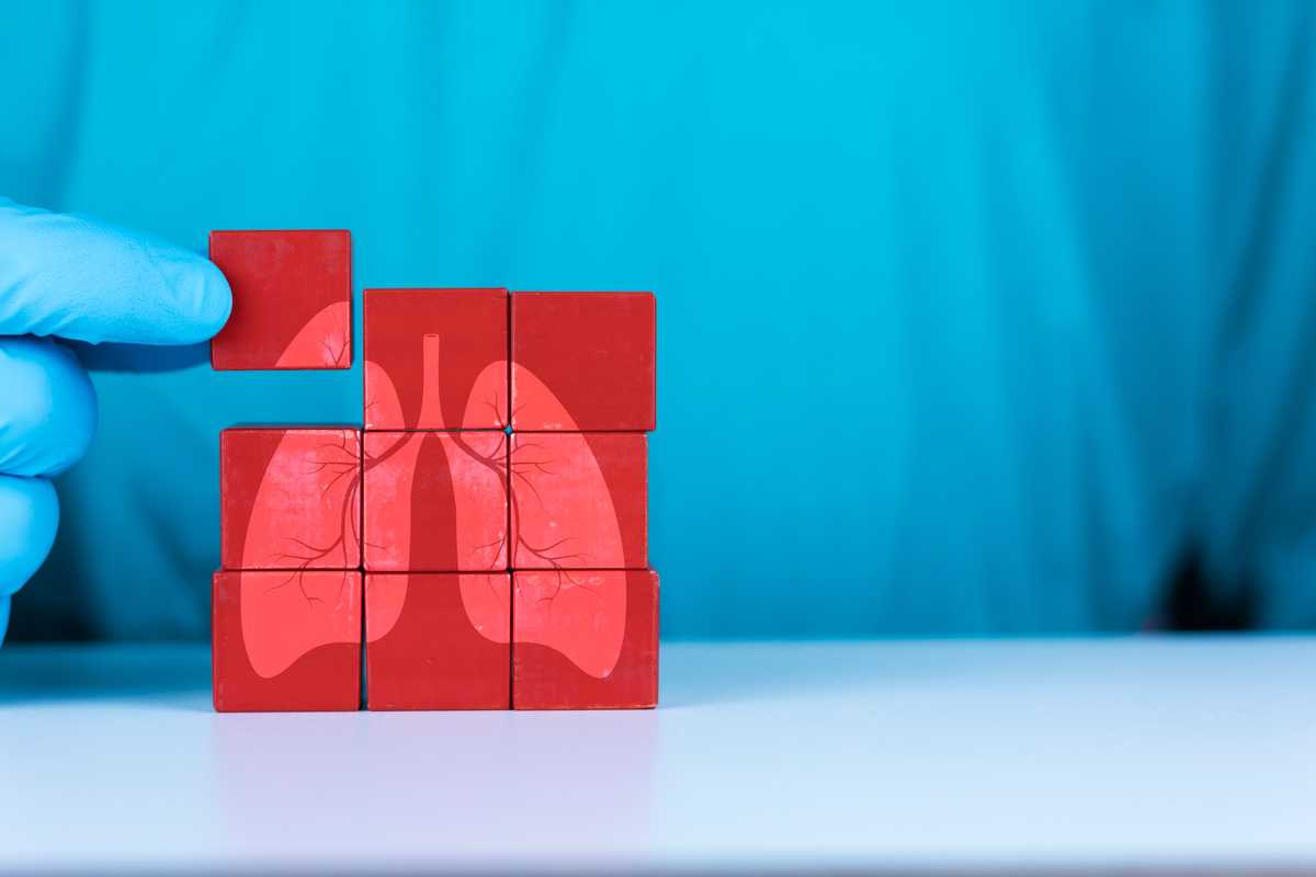 Why does organ donation remain a taboo in Pakistan