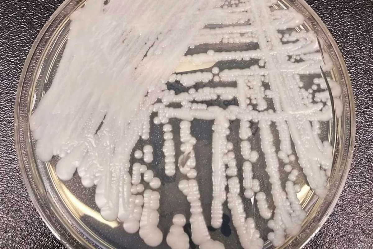 Candida auris Clade VI detected in Abu Dhabi wastewater
