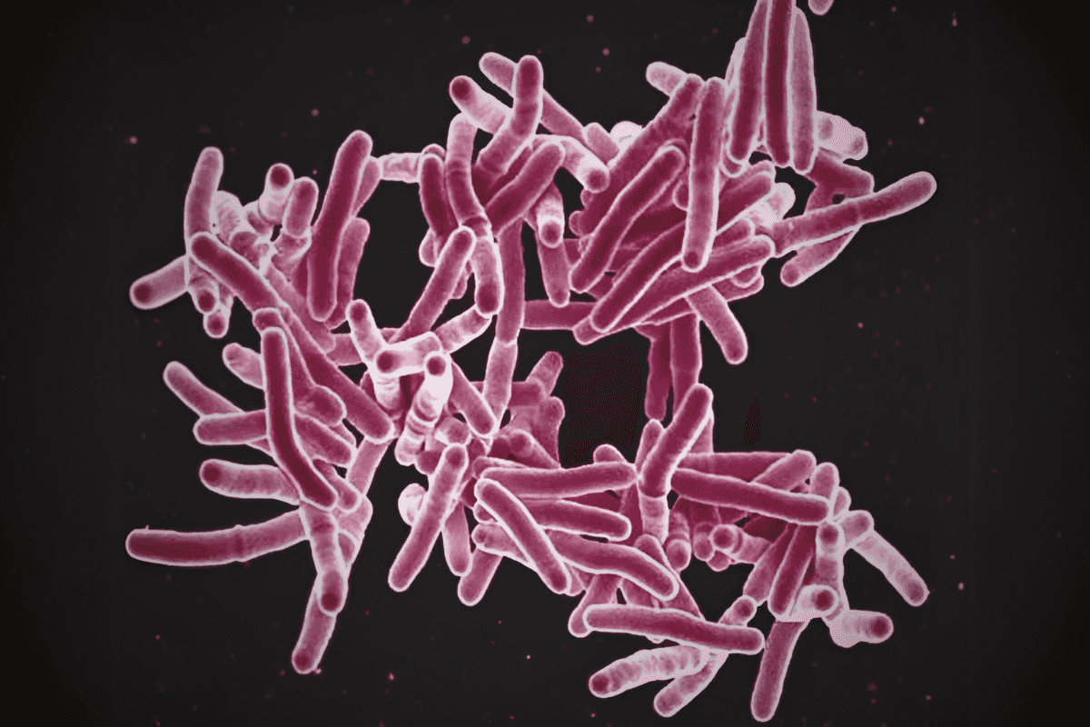 Tuberculosis cases hit record high: WHO