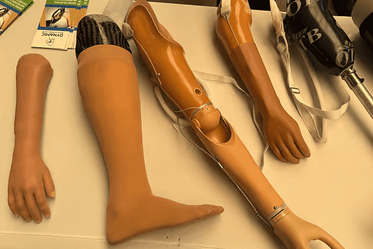 UAE launches Step of Hope program to provide prosthetic limbs to Gaza war victims