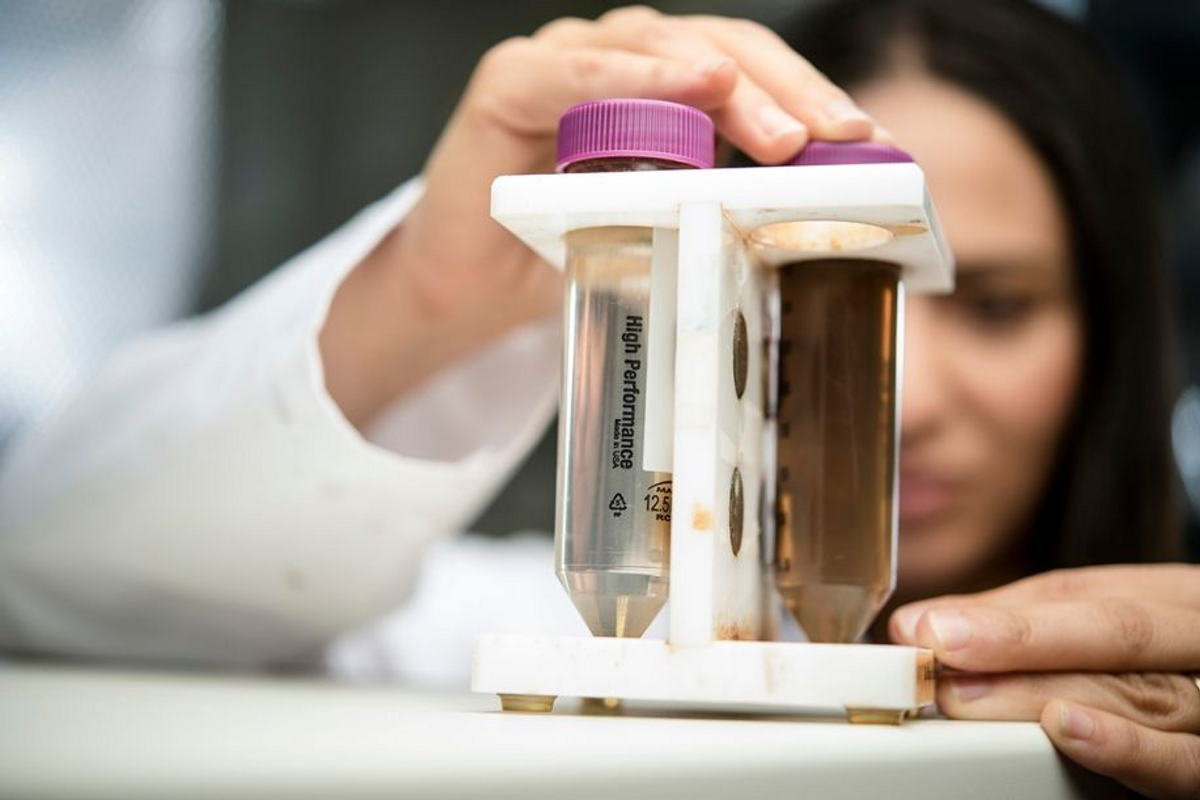 NYU Abu Dhabi researchers develop tool to enhance cancer cell detection in cryosurgery