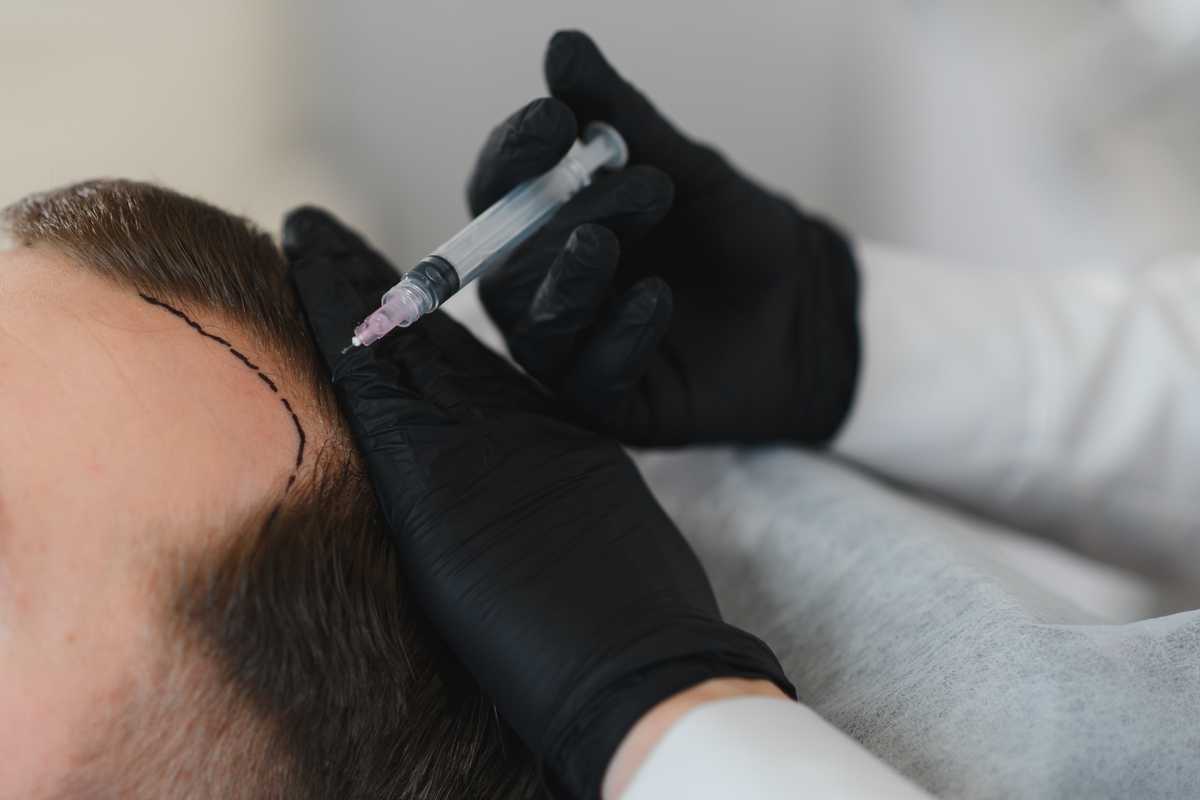 Dubai Police arrest man running illegal hair transplant clinic from apartment