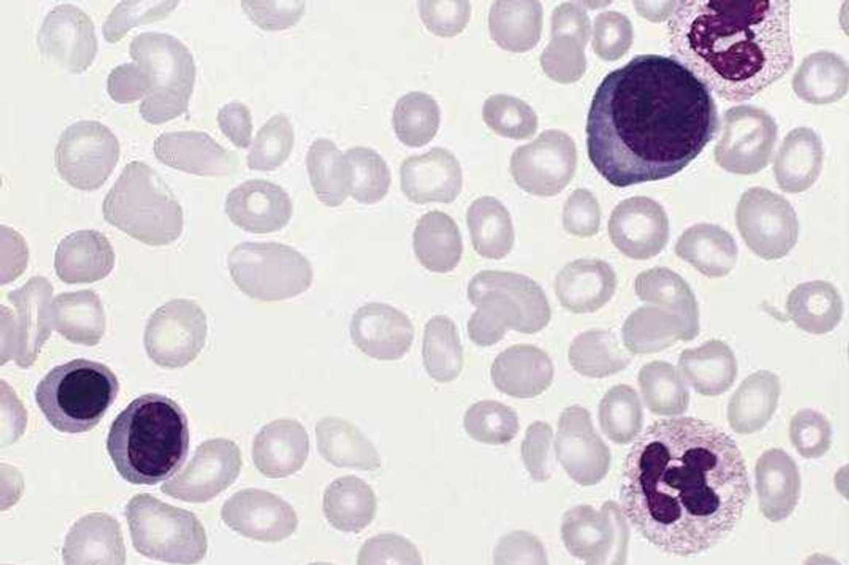 UAE approves rusfertide (MIMRYLO) for adults with rare blood disorder polycythemia vera